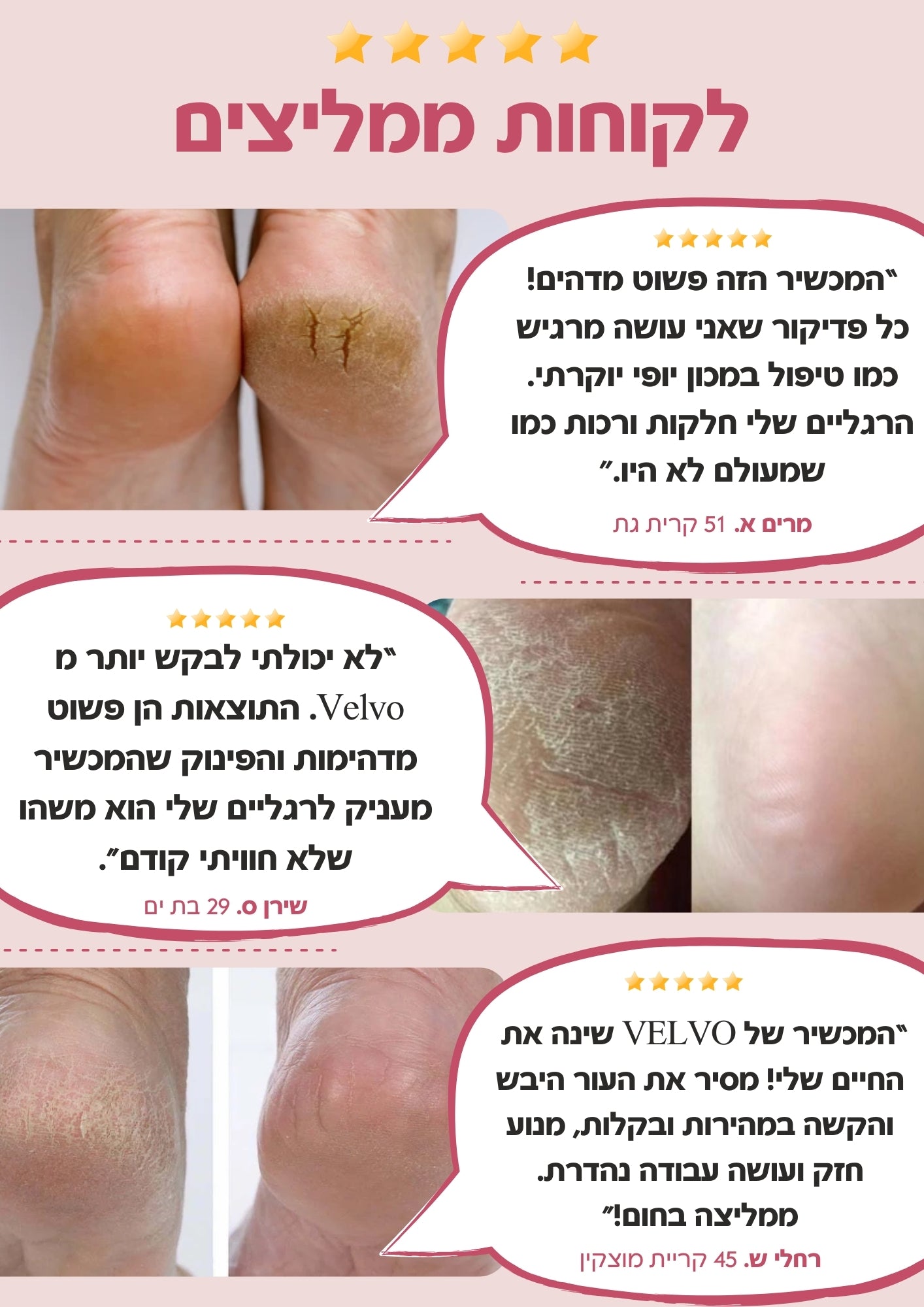 Velvo™ - מכשיר פדיקור חשמלי מקצועי לשיוף והסרת עור יבש מכפות הרגליים