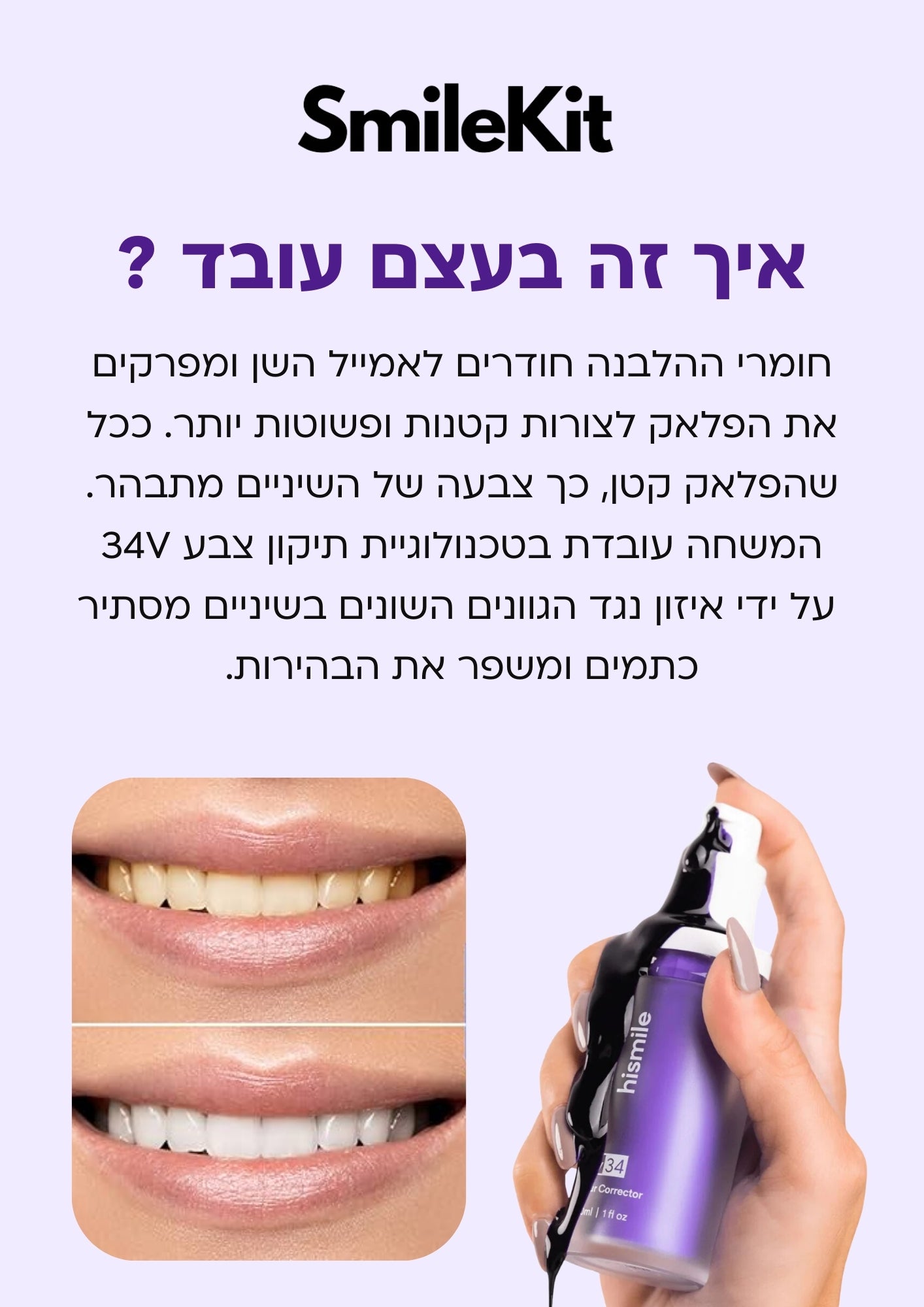 SmileKit - משחה להלבנת שיניים המקורית!