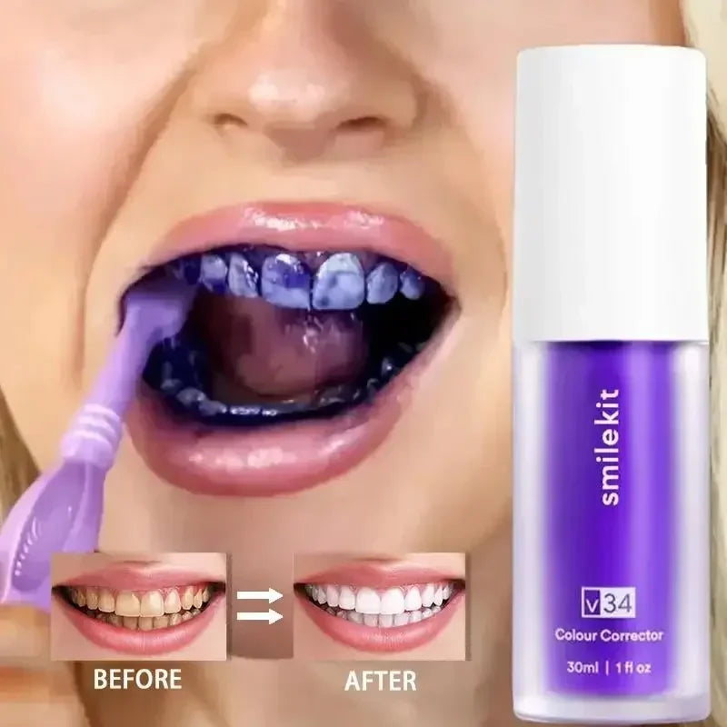 SmileKit - משחה להלבנת שיניים המקורית!